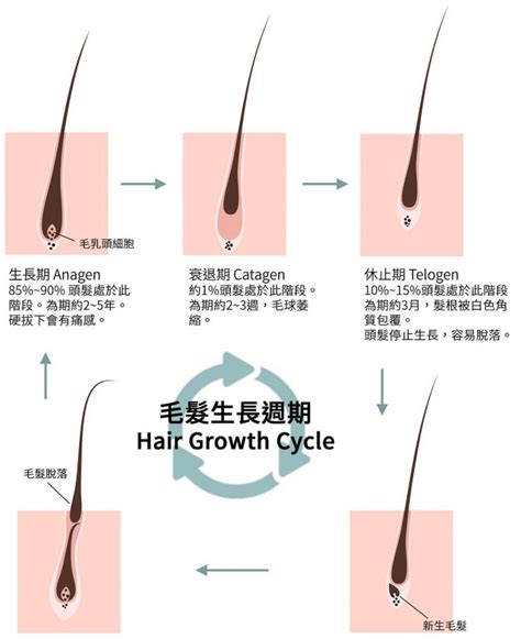 毛髮多|造成多毛的原因